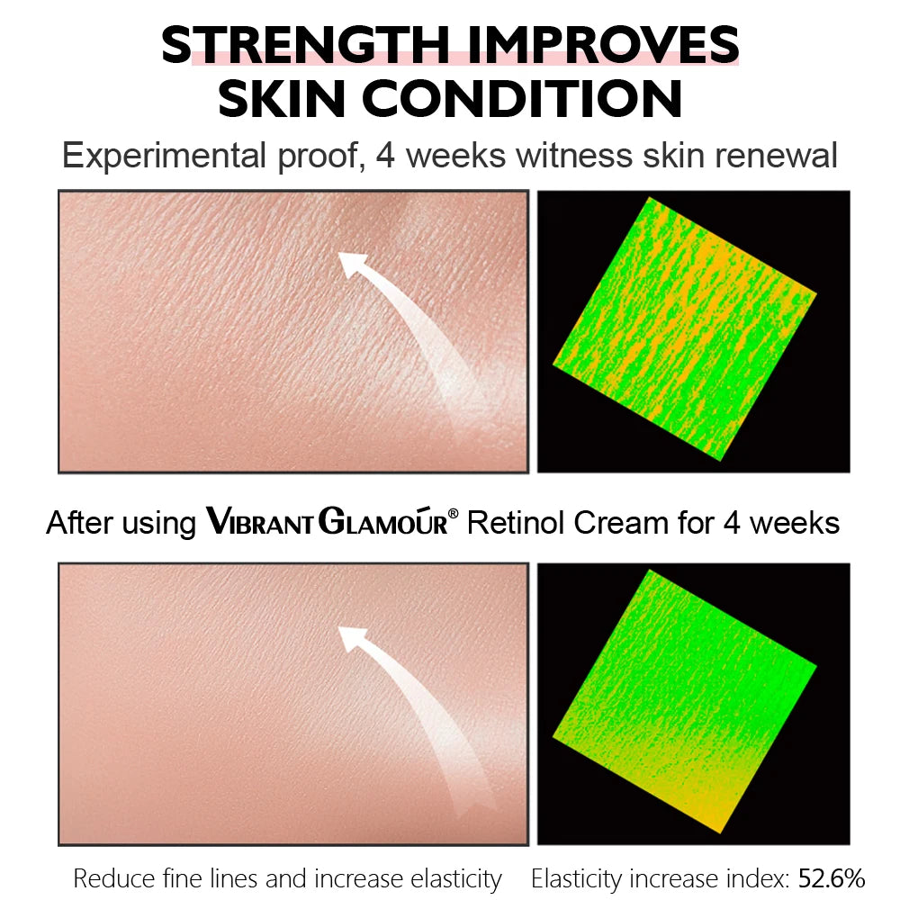 Crème Visage au Rétinol Anti-Âge – Hydratante & Raffermissante